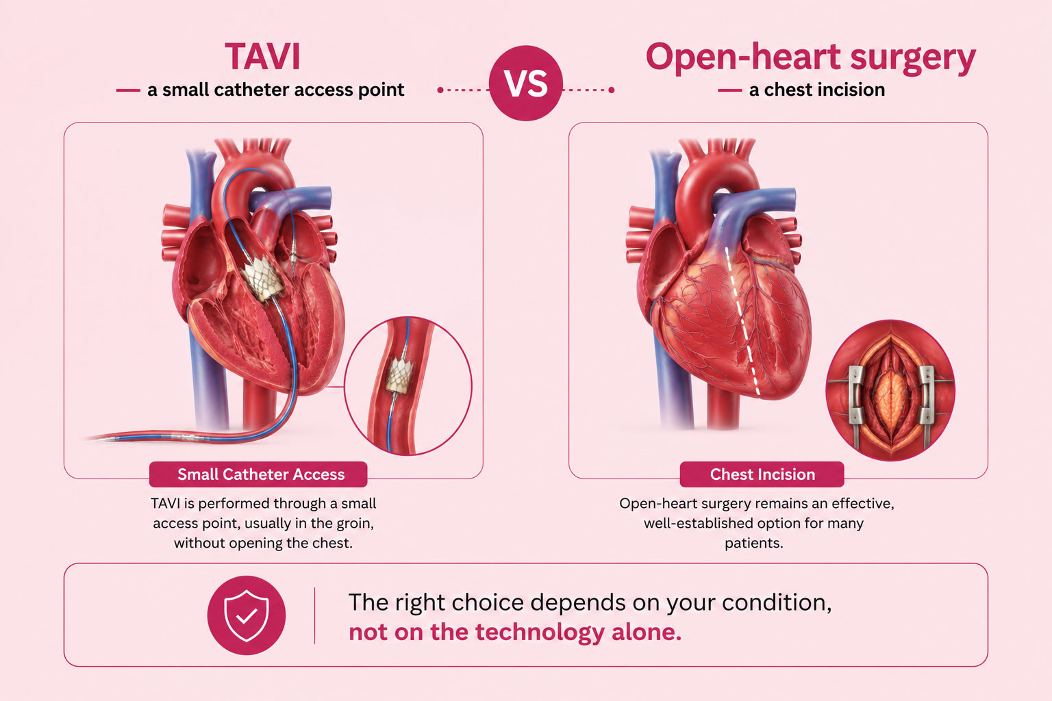TAVI and Open-heart surgery