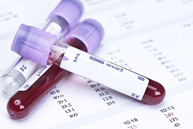 Hematology