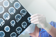Neuro Surgery