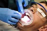 Oral and Maxillo-Facial surgery