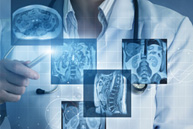 Vascular Interventional Radiology